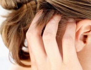 sinais e sintomas de psoríase no couro cabeludo